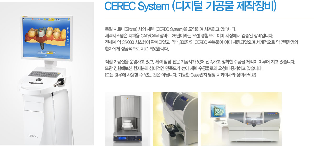 CEREC System (디지털 기공물 제작장비)